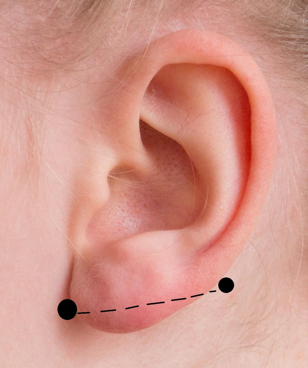 what is transverse lobe piercing?