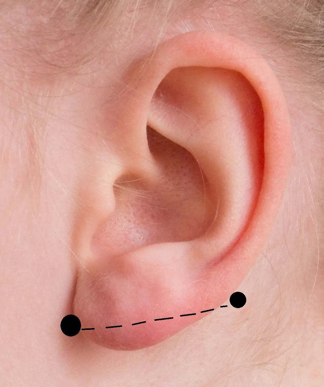 what is transverse lobe piercing?