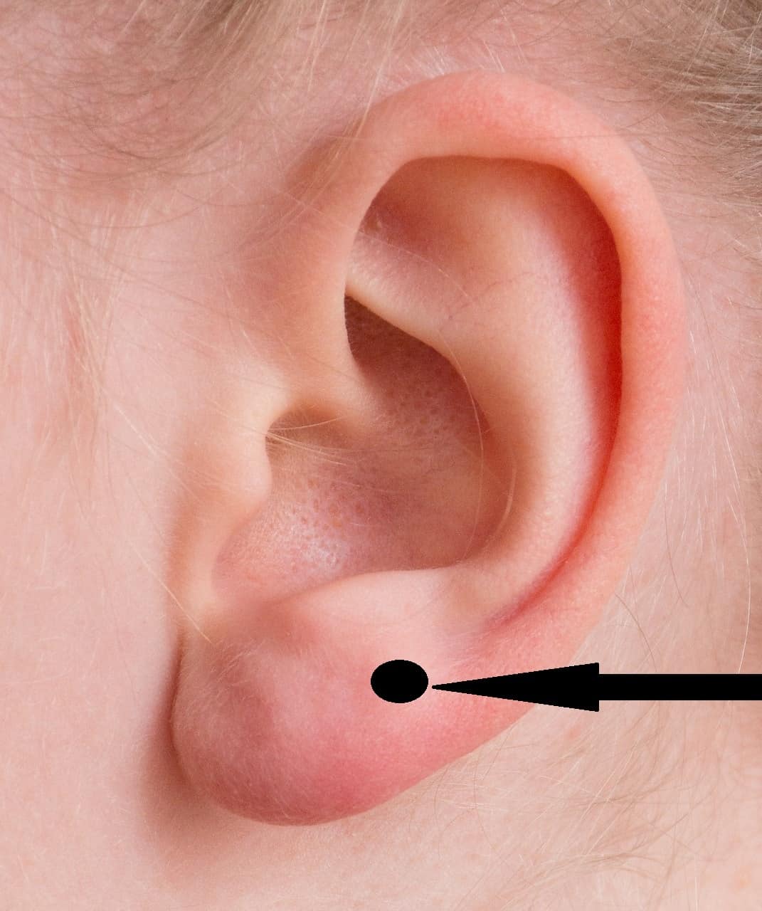 upper lobe piercing guide