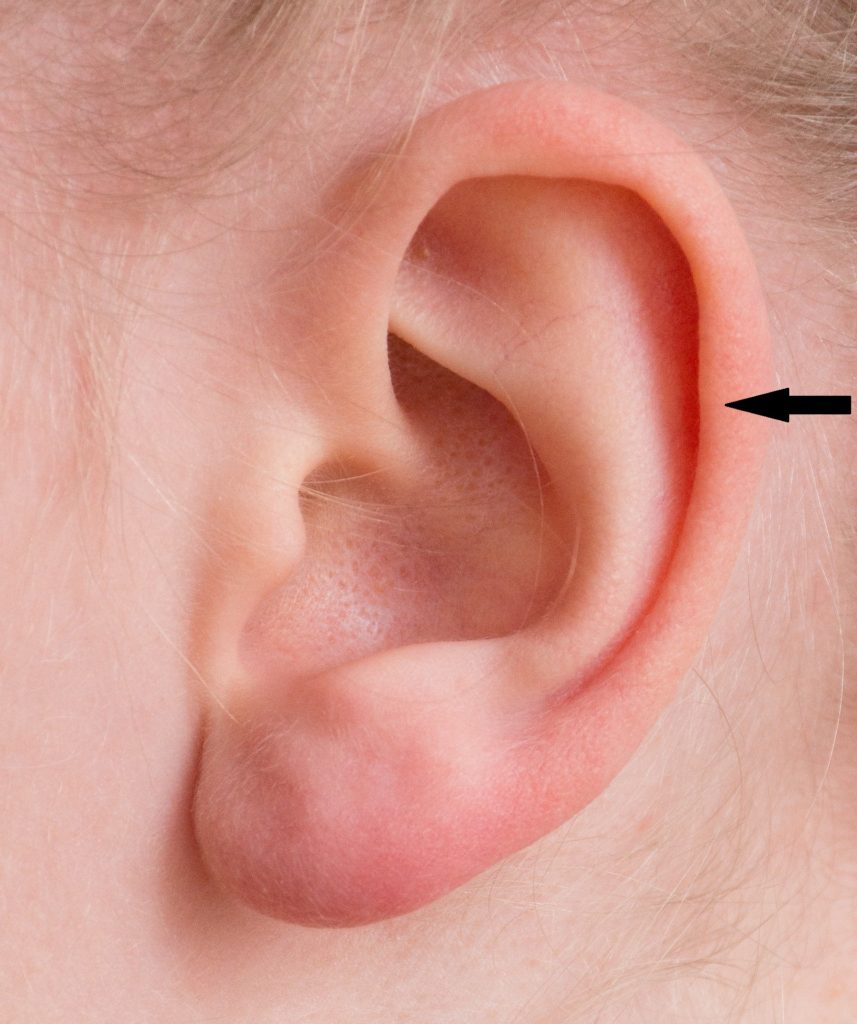 auricle earrings