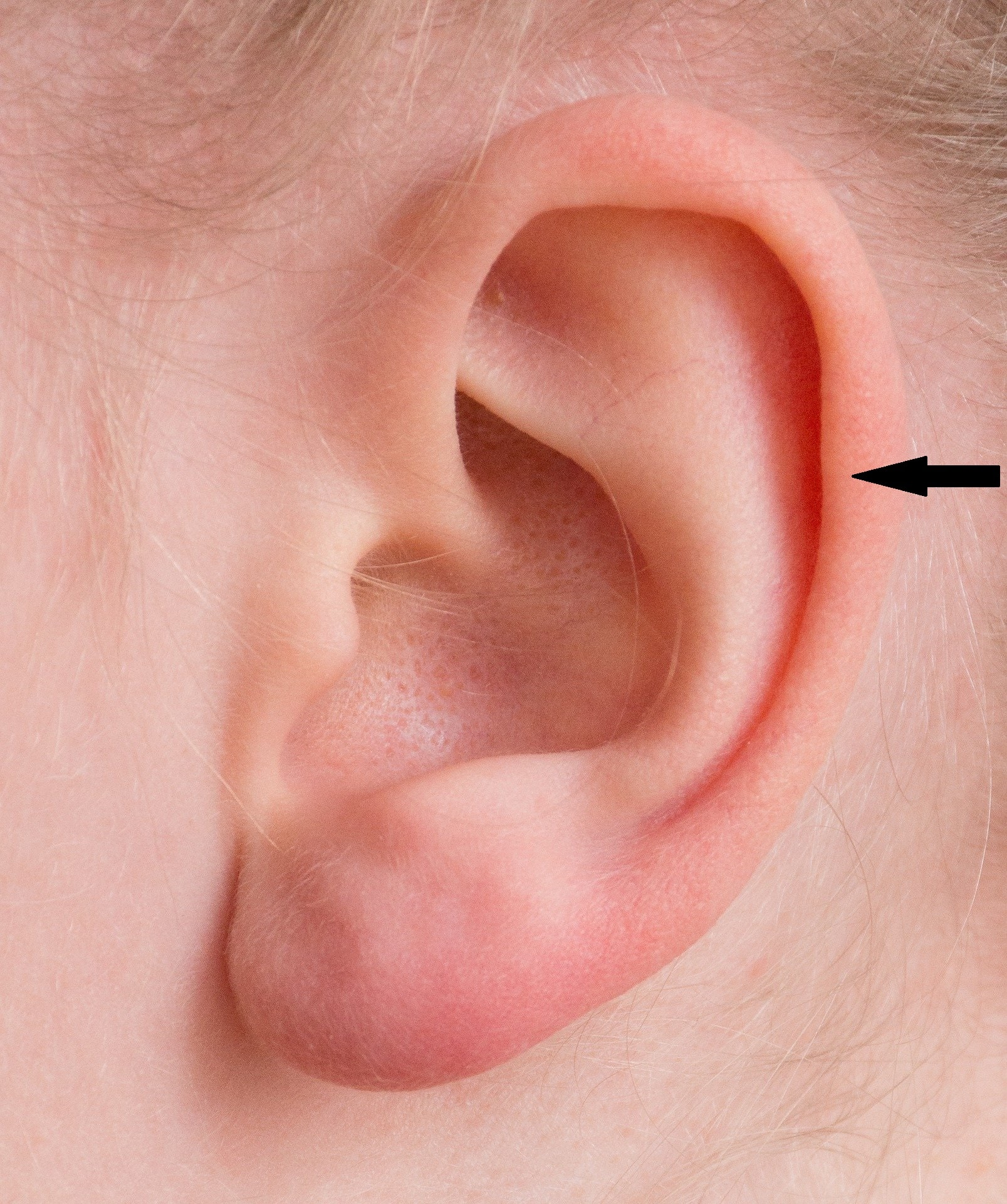 Auricle piercing location in ear