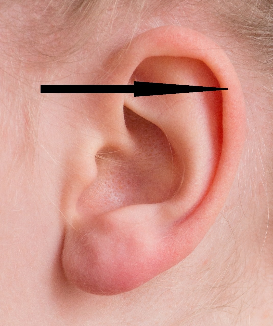Helix piercing location on ear