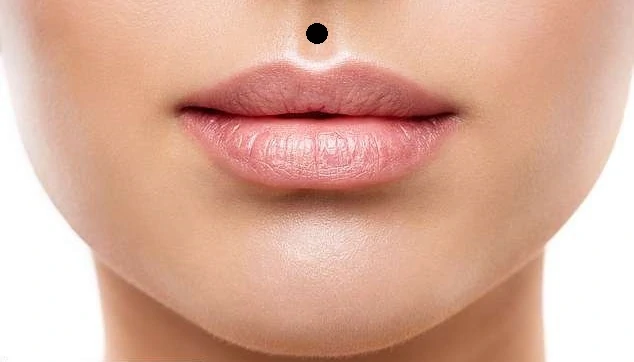 Medusa piercing