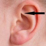 Rook piercing location on ear