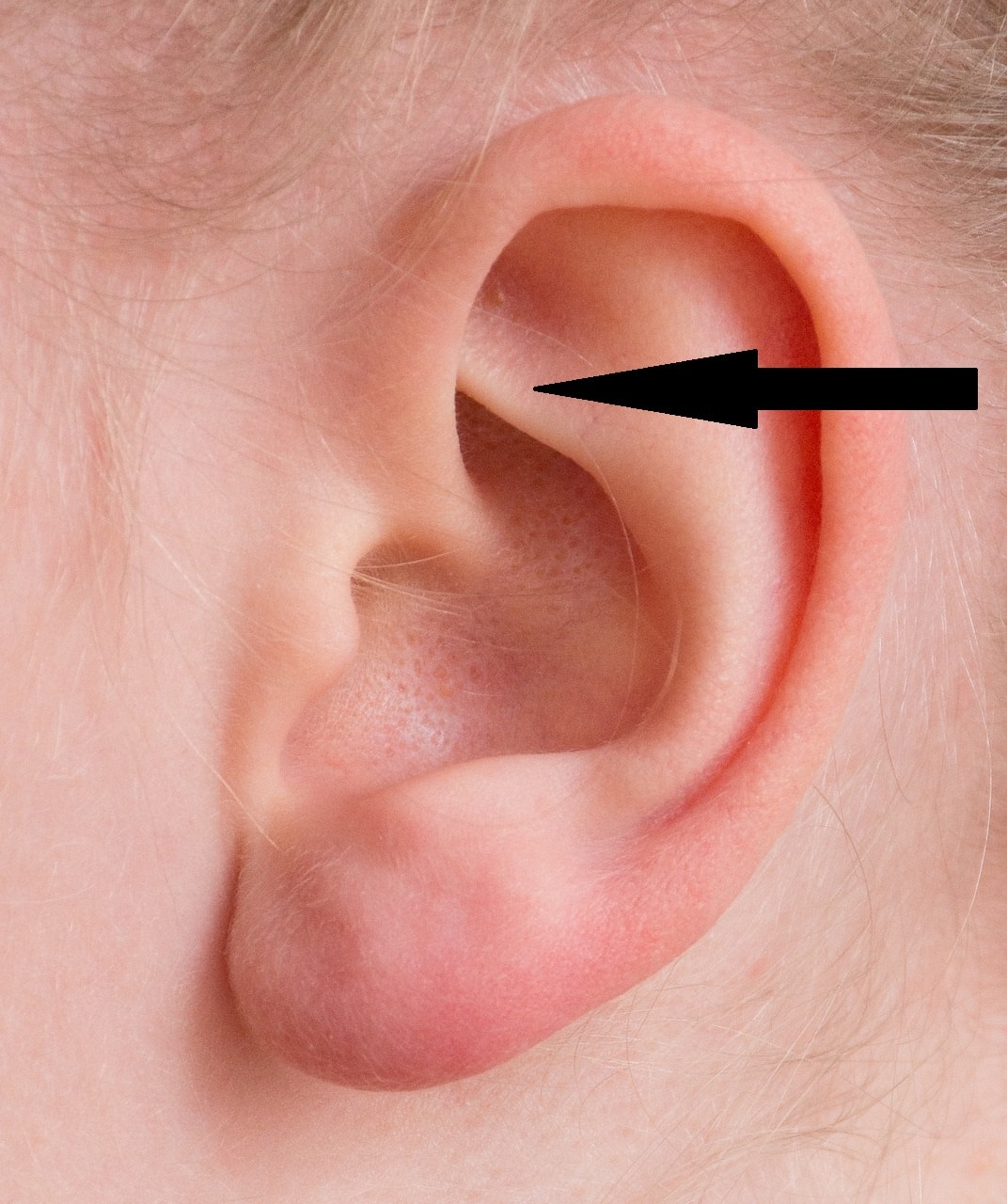 Rook piercing location on ear