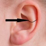 Snug piercing location on ear