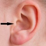 Tragus piercing location on ear