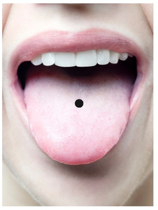 midline tongue piercing