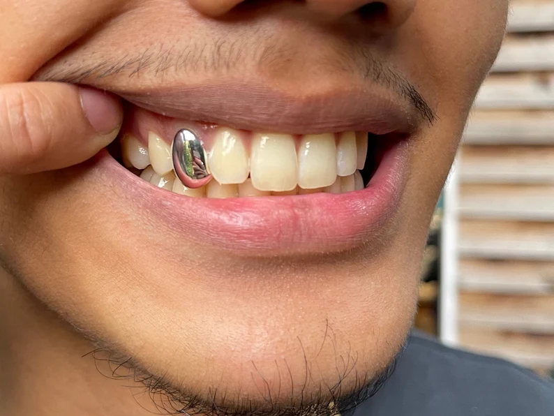 a man with a sterling silver tooth cap grillz